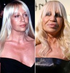 Celebrity-plastic-surgery-donatella versace