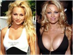 Celebrities Before & After