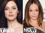 Rose-McGowan-Plastic-Surgery-Pictures